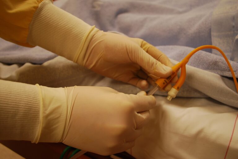 Cateteri Vescicali: Utilizzo, Infezioni, Prevenzione e Casistica