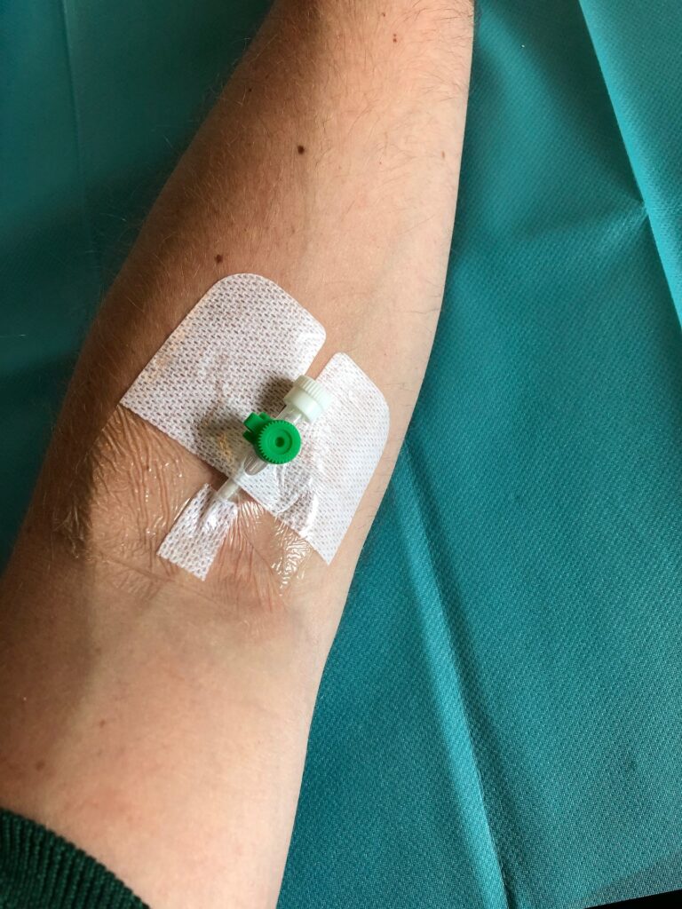 Accessi Vascolari: PICC , Implantazione e Gestione