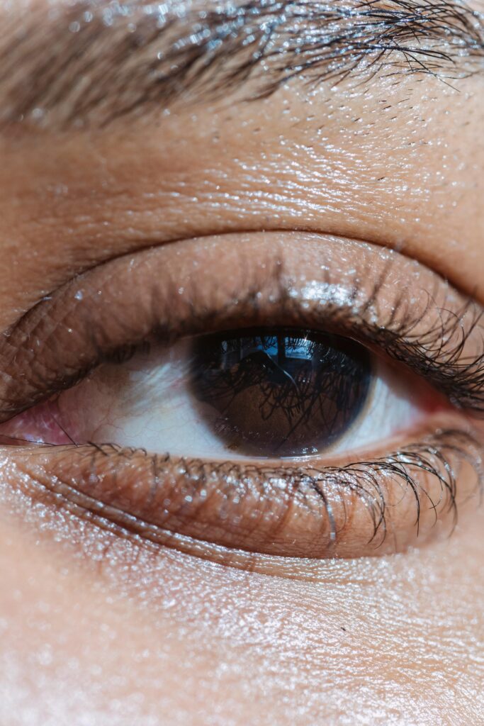 ⭐ Occhiaie: Cause, Tipologie e Rimedi Effettivi per uno Sguardo Più Riposato